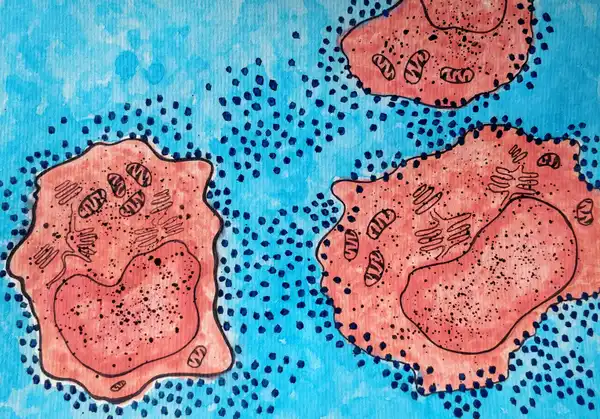 Cells affected by viruses. Here, T-lymphocytes are depicted as being affected by Human Immunodeficiency Virus (HIV) particles. © Sunaina Rao.