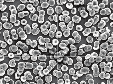 Microscopy image of red blood cells. Credit: Ruihu Wang and Bin Fang [(CC BY 3.0)](https://creativecommons.org/licenses/by/3.0/).