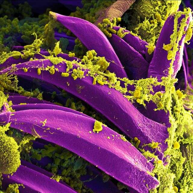 A high resolution microscopy image of the bacteria that causes bubonic plague - *Yersinia pestis* (purple). Credit: [Wikimedia](https://commons.wikimedia.org/wiki/File:Yersinia_pestis_Bacteria.jpg).