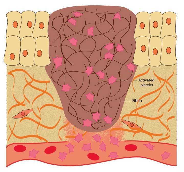 In the haemostasis phase, the blood oozing out of the blood vessels is blocked. This is achieved by the platelets, which help in the synthesis of a protein mesh made of fibrin. © Sunaina Rao