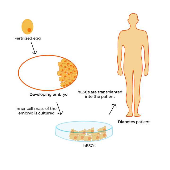 Stem cell replacement