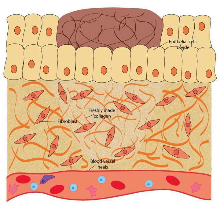 In the proliferative phase, the epithelial cells divide to cover the wound opening, the fibroblasts in the extracellular matrix (ECM) secrete fresh collagen and the ruptured blood vessels heal.  © Sunaina Rao