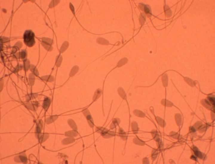 Sperm cells of a bull as seen under a microscope. They show the typical head and tail structure. Credit: [Wikimedia](https://commons.wikimedia.org/wiki/File:Sperm_Cells_of_Bull_(430_times_magnification).jpg).